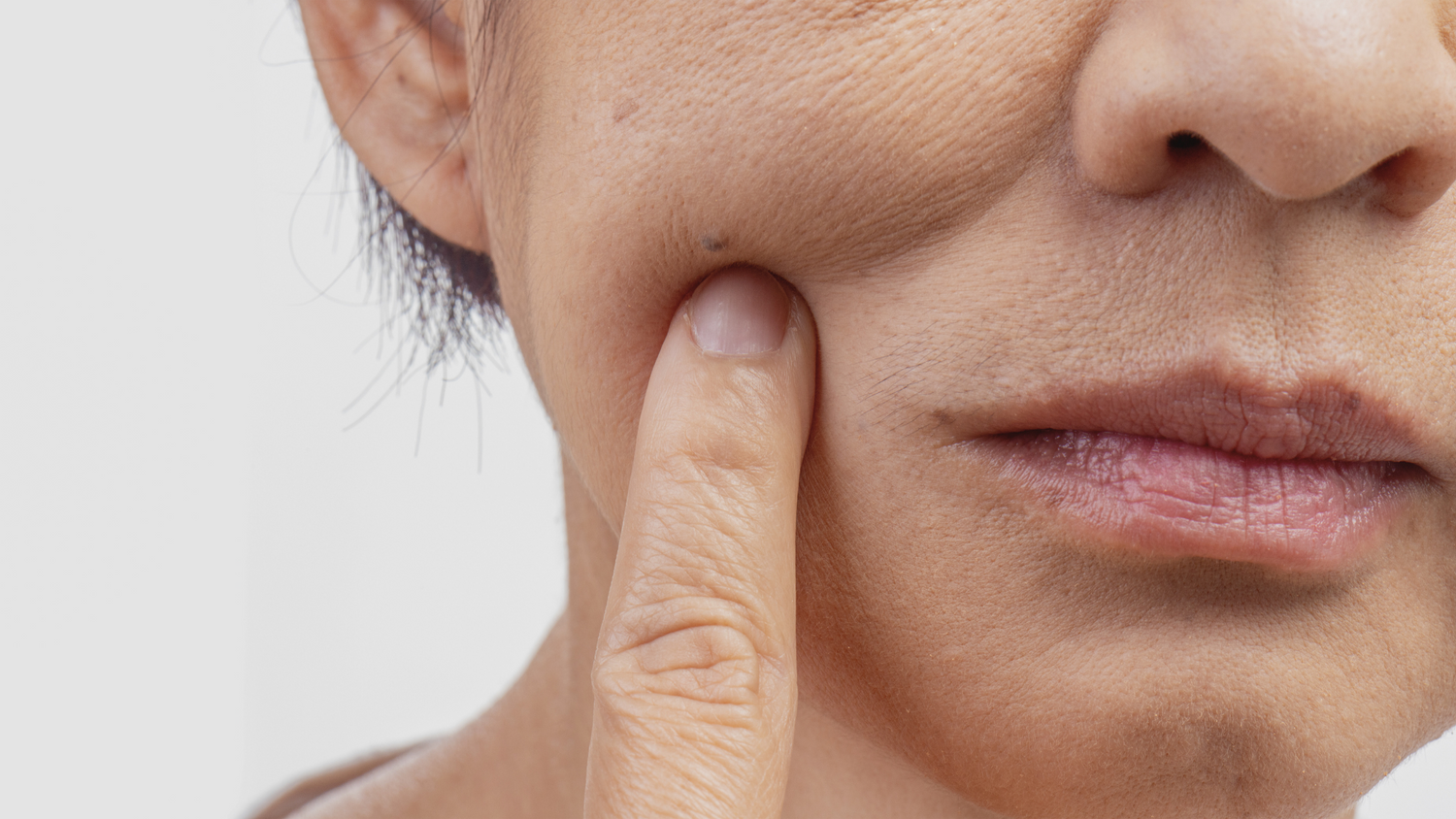 How Stress Affects the Skin: Exploring the Mind-Body Connection