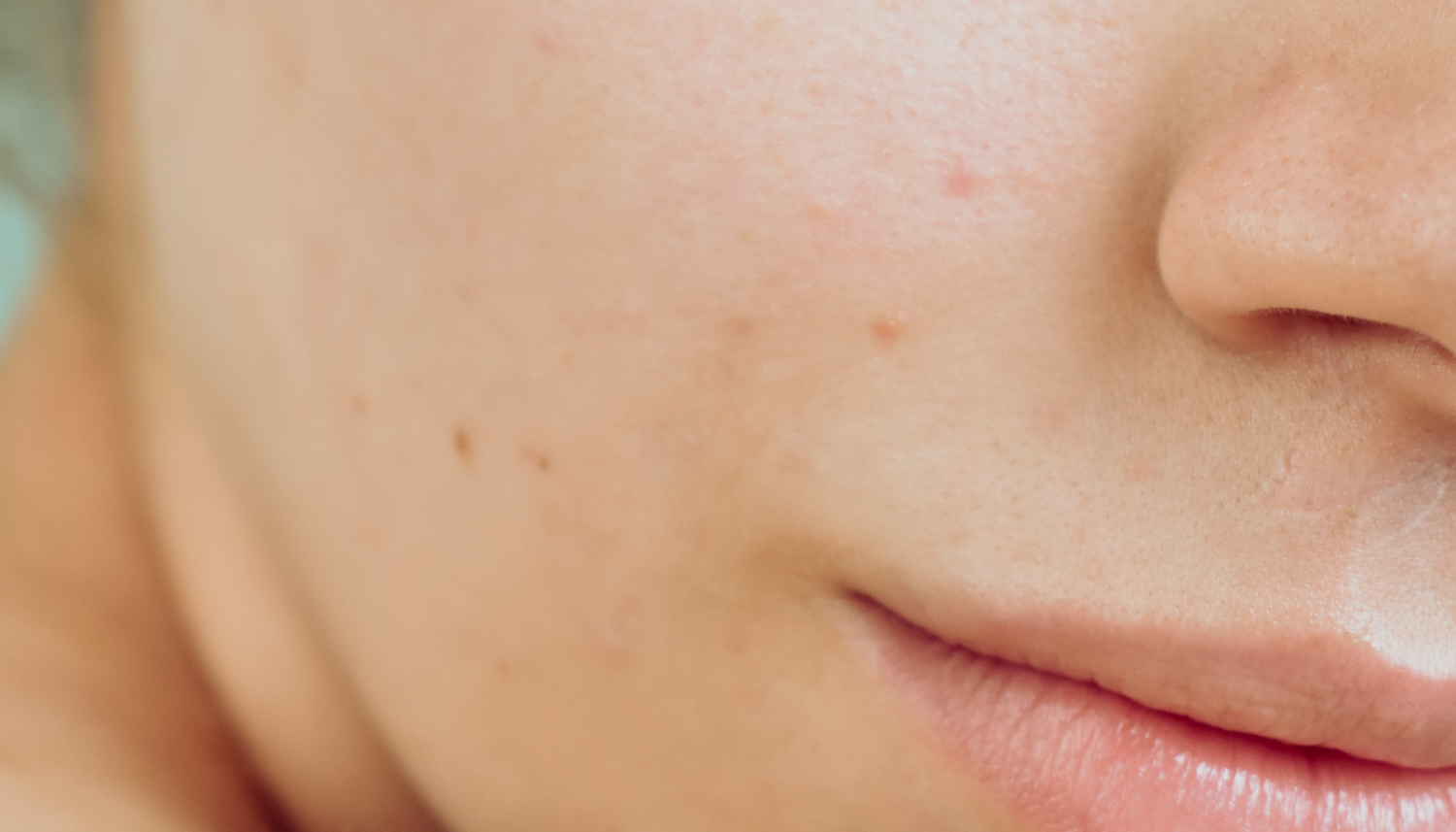 The Truth About pH Balance: Why Your Skin Needs the Right Support